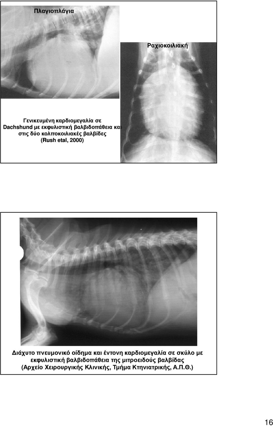 πνευµονικό οίδηµα και έντονη καρδιοµεγαλία σε σκύλο µε εκφυλιστική βαλβιδοπάθεια