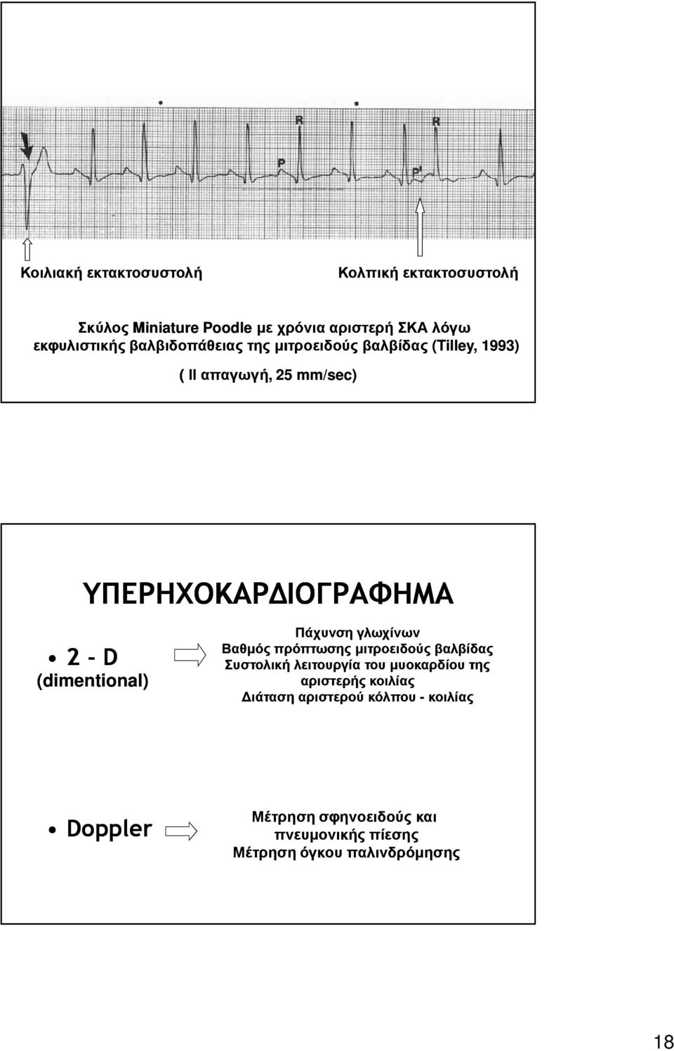 (dimentional) Πάχυνση γλωχίνων Βαθµός πρόπτωσης µιτροειδούς βαλβίδας Συστολική λειτουργία του µυοκαρδίου της