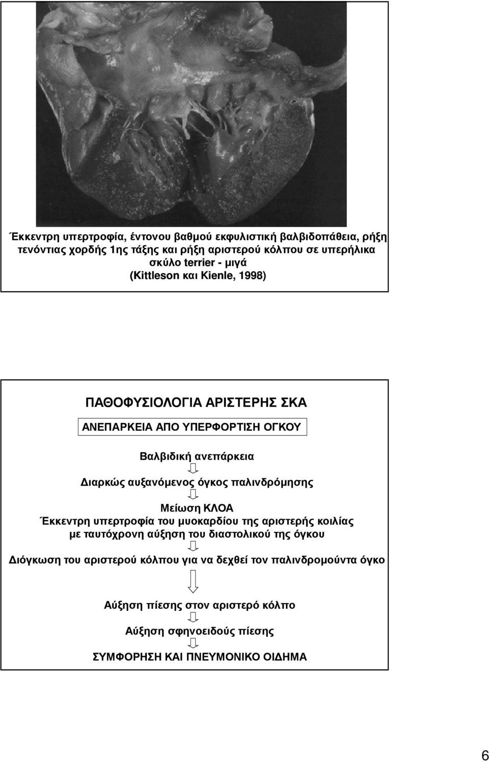 όγκος παλινδρόµησης Μείωση ΚΛΟΑ Έκκεντρη υπερτροφία του µυοκαρδίου της αριστερής κοιλίας µε ταυτόχρονη αύξηση του διαστολικού της όγκου ιόγκωση