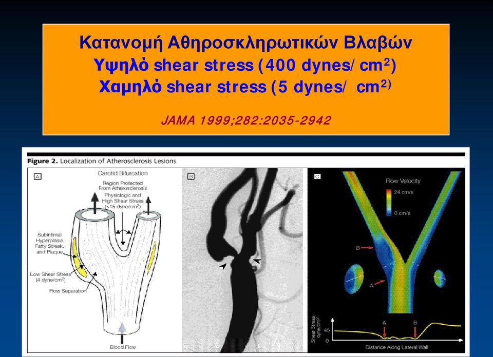 2 ) Χαμηλό shear stress (5