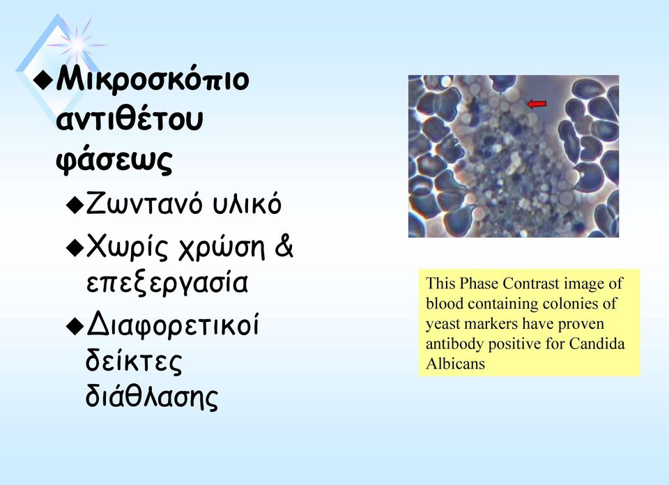 Contrast image of blood containing colonies of yeast
