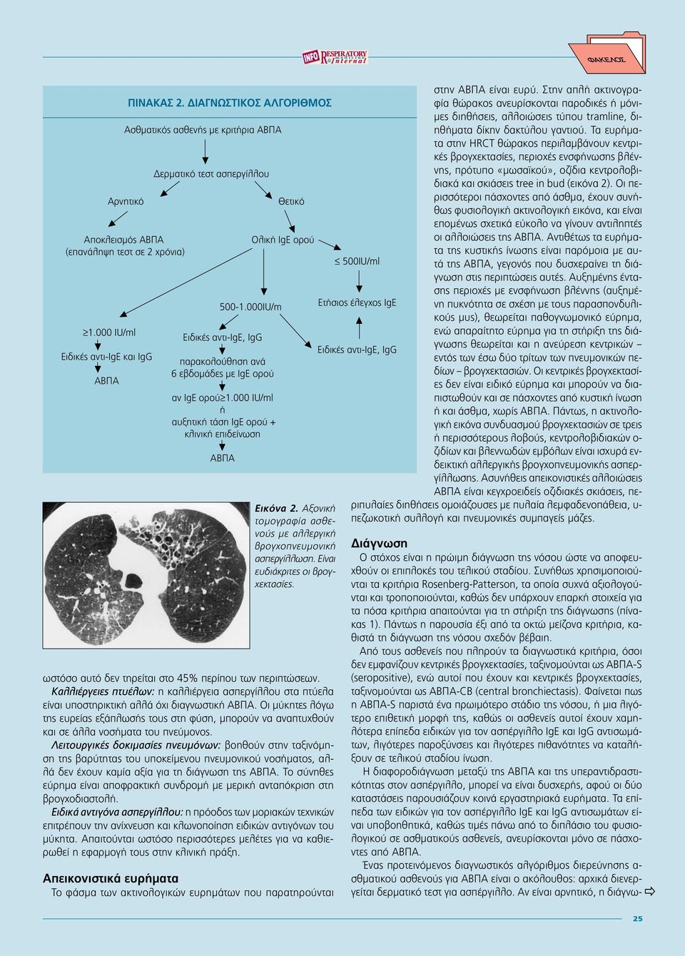 000 IU/ml ή αυξητική τάση IgE ορού + κλινική επιδείνωση ΑΒΠΑ Θετικό Ολική IgE ορού Εικόνα 2. Αξονική τομογραφία ασθενούς με αλλεργική βρογχοπνευμονική ασπεργίλλωση. Είναι ευδιάκριτες οι βρογχεκτασίες.