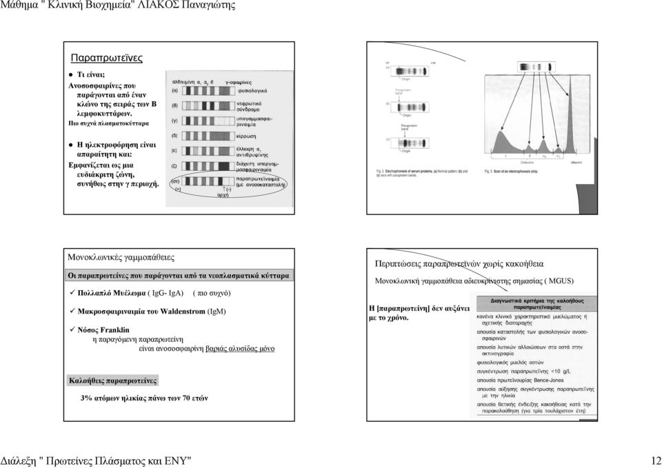 Μονοκλωνικές γαµµοπάθειες Οι παραπρωτείνες που παράγονται από τα νεοπλασµατικά κύτταρα Πολλαπλό Μυέλωµα ( IgG- IgA) ( πιο συχνό) Μακροσφαιριναιµία του Waldenstrom (IgM) Νόσος