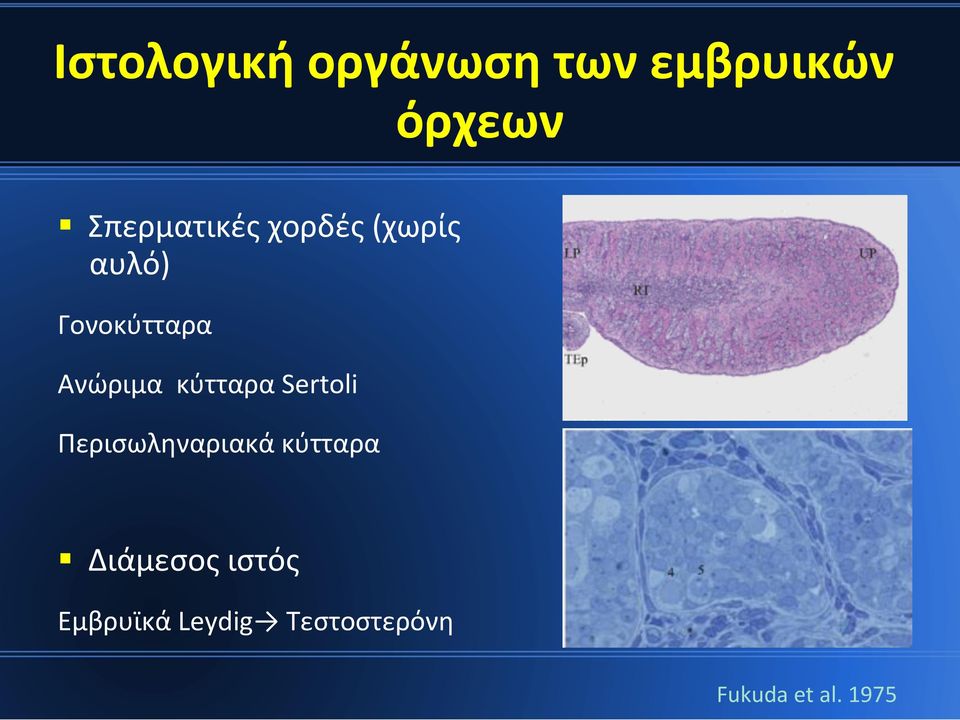 Ανώριμα κύτταρα Sertoli Περισωληναριακά κύτταρα