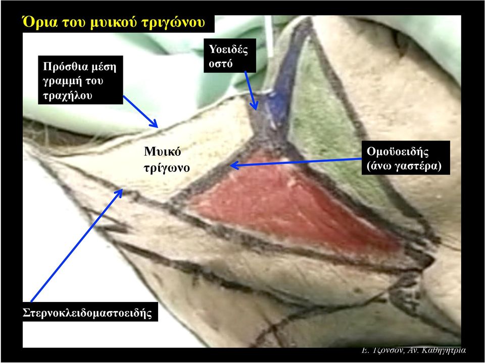 τραχήλου Μυικό τρίγωνο