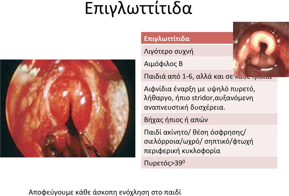 αναπνευστική δυσχέρεια.