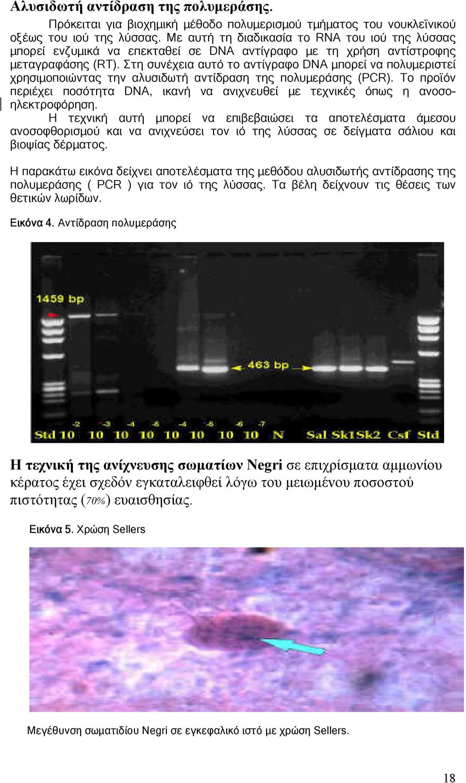 Στη συνέχεια αυτό το αντίγραφο DNA µπορεί να πολυµεριστεί χρησιµοποιώντας την αλυσιδωτή αντίδραση της πολυµεράσης (PCR).