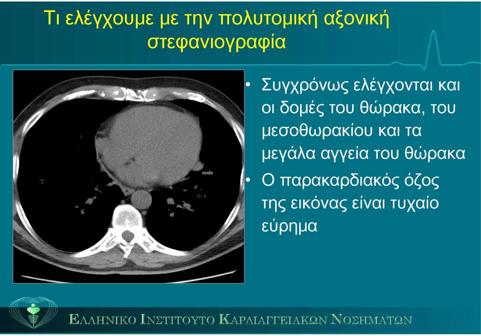 του θώρακα, του μεσοθωρακίου και τα μεγάλα αγγεία