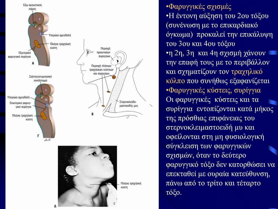 φαρυγγικές κύστεις και τα συρίγγια εντοπίζονται κατά μήκος της πρόσθιας επιφάνειας του στερνοκλειμαστοειδή μυ και οφείλονται στη μη φυσιολογική