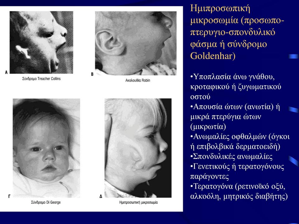 πτερύγια ώτων (μικρωτία) Ανωμαλίες οφθαλμών (όγκοι ή επιβολβικά δερματοειδή) Σπονδυλικές