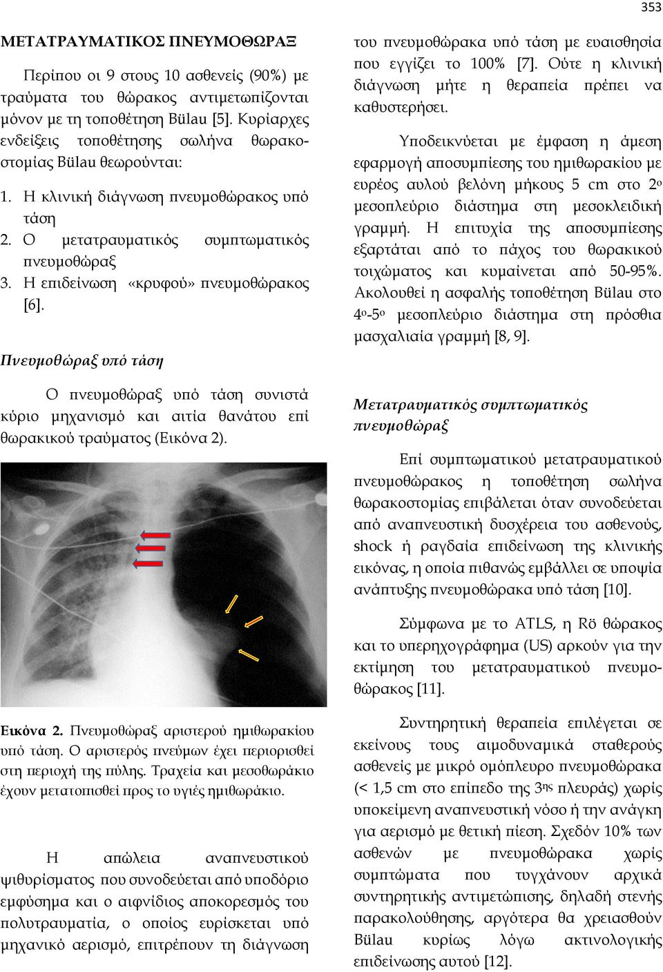 Η επιδείνωση «κρυφού» πνευμοθώρακος [6]. Πνευμοθώραξ υπό τάση Ο πνευμοθώραξ υπό τάση συνιστά κύριο μηχανισμό και αιτία θανάτου επί θωρακικού τραύματος (Εικόνα 2).