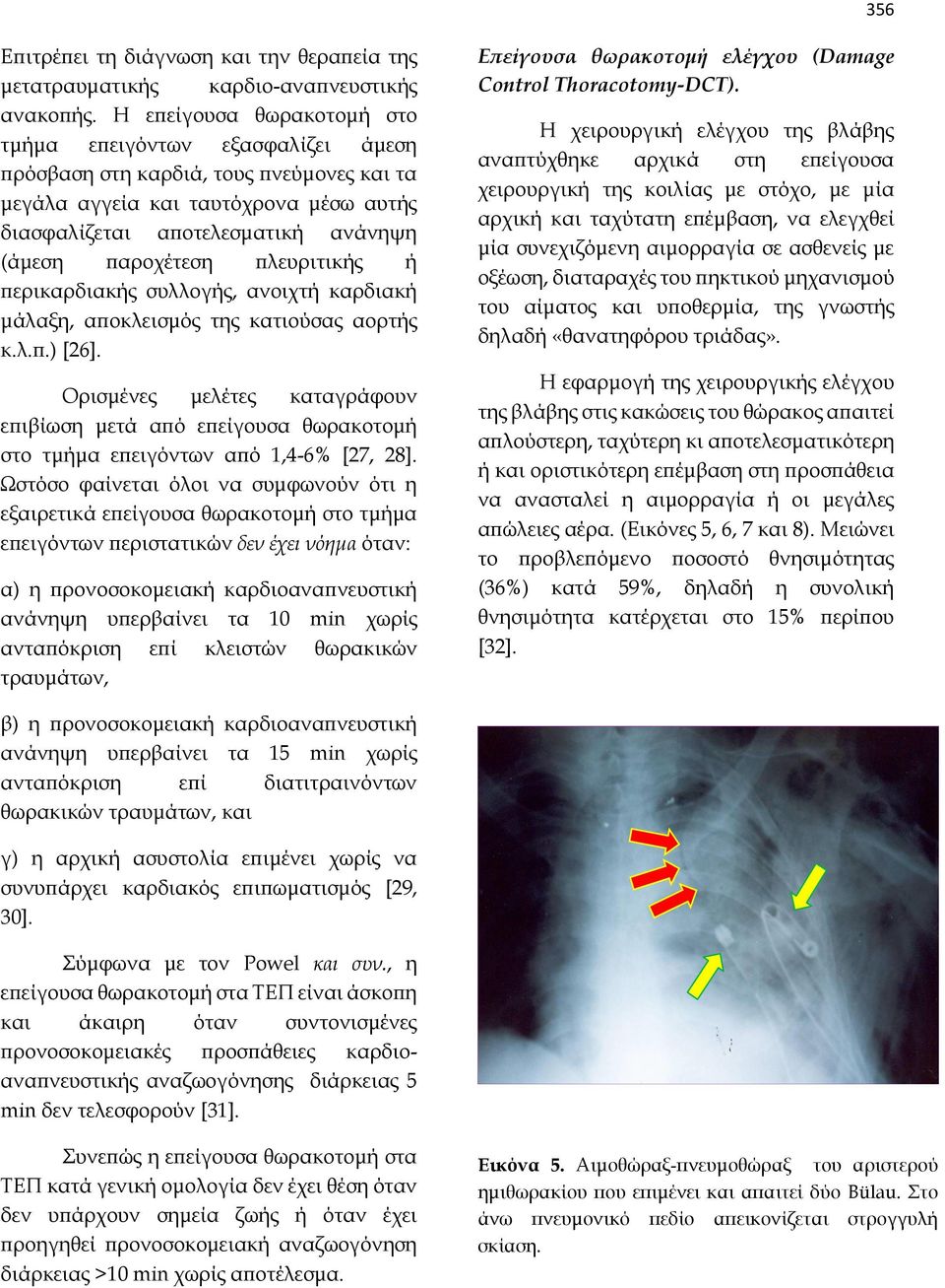 πλευριτικής ή περικαρδιακής συλλογής, ανοιχτή καρδιακή μάλαξη, αποκλεισμός της κατιούσας αορτής κ.λ.π.) [26].