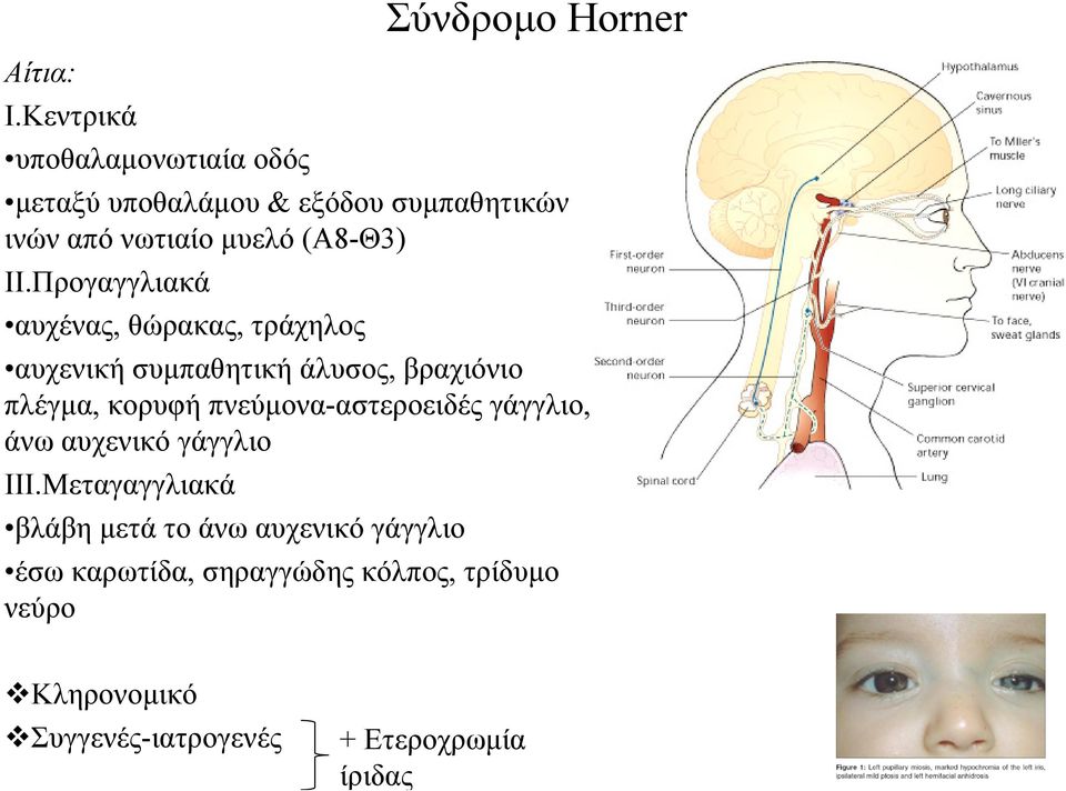 Προγαγγλιακά αυχένας, θώρακας, τράχηλος αυχενική συμπαθητική άλυσος, βραχιόνιο πλέγμα, κορυφή