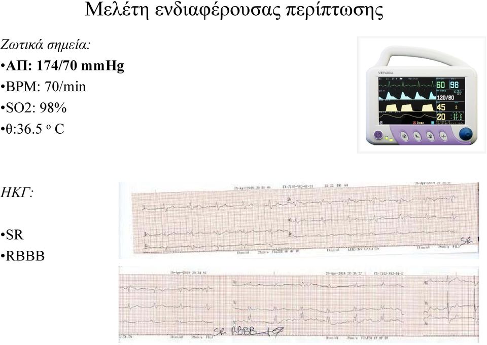 θ:36.5 ο C Μελέτη