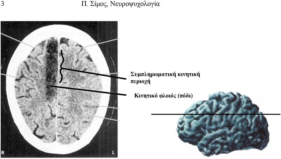 Συμπληρωματική