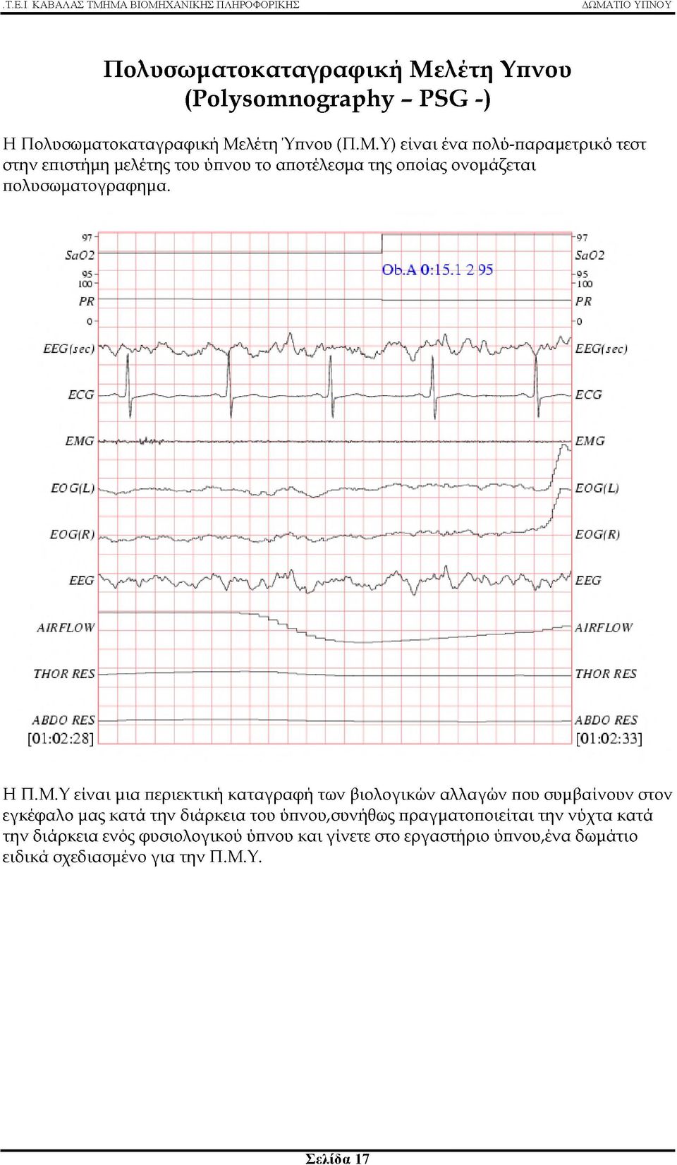 Υ) είναι ένα πολύ-παραμετρικό τεστ στην επιστήμη μελέτης του ύπνου το αποτέλεσμα της οποίας ονομάζεται πολυσωματογραφημα. Η Π.Μ.