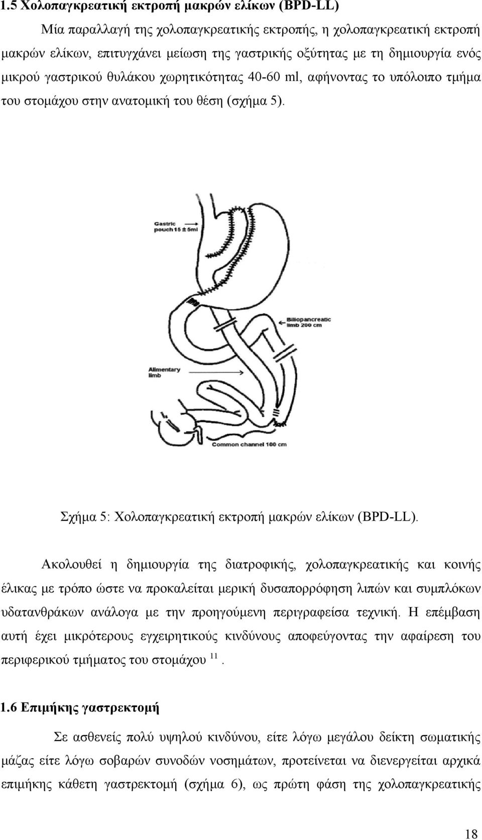 Ακολουθεί η δημιουργία της διατροφικής, χολοπαγκρεατικής και κοινής έλικας με τρόπο ώστε να προκαλείται μερική δυσαπορρόφηση λιπών και συμπλόκων υδατανθράκων ανάλογα με την προηγούμενη περιγραφείσα