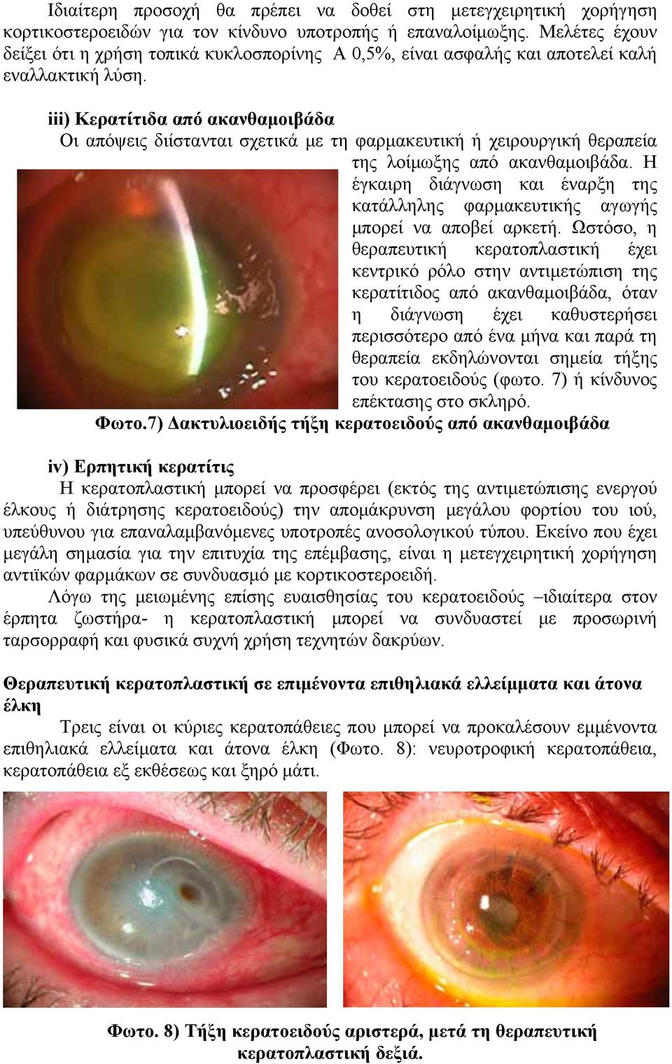 iii) Κερατίτιδα από ακανθαμοιβάδα Οι απόψεις διίστανται σχετικά με τη φαρμακευτική ή χειρουργική θεραπεία της λοίμωξης από ακανθαμοιβάδα.