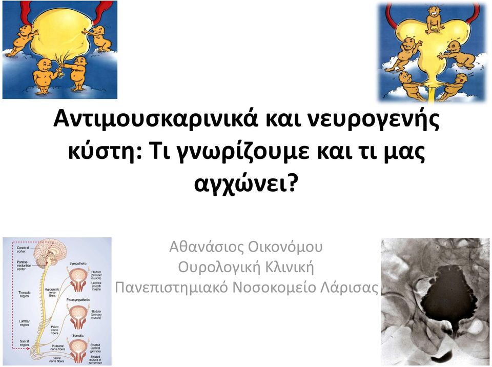 αγχώνει?