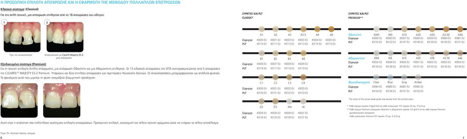 5 A4 A6 Σύριγγα #3020-EU #3021-EU #3022-EU #3023-EU #3024-EU #3025-EU PLT #3110-EU #3111-EU #3112-EU #3113-EU #3114-EU #3115-EU Oδοντίνη XWD WD A1D A2D A3D A3.