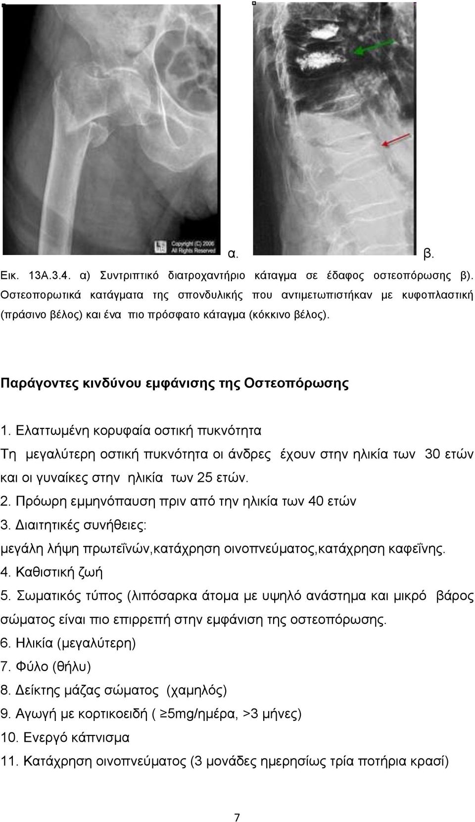 Ελαττωµένη κορυφαία οστική πυκνότητα Τη µεγαλύτερη οστική πυκνότητα οι άνδρες έχουν στην ηλικία των 30 ετών και οι γυναίκες στην ηλικία των 25 ετών. 2. Πρόωρη εµµηνόπαυση πριν από την ηλικία των 40 ετών 3.