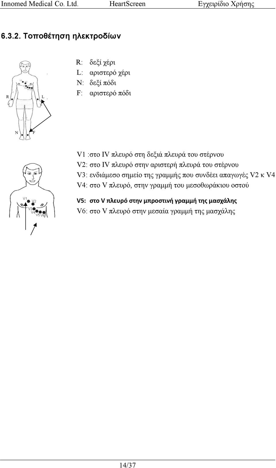 πλευρό στη δεξιά πλευρά του στέρνου V2: στο IV πλευρό στην αριστερή πλευρά του στέρνου V3: ενδιάμεσο