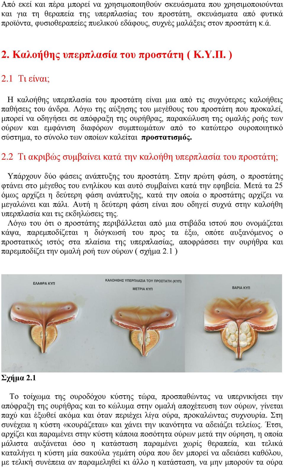 Λφγσ ηεο αχμεζεο ηνπ κεγέζνπο ηνπ πξνζηάηε πνπ πξνθαιεί, κπνξεί λα νδεγήζεη ζε απφθξαμε ηεο νπξήζξαο, παξαθψιπζε ηεο νκαιήο ξνήο ησλ νχξσλ θαη εκθάληζε δηαθφξσλ ζπκπησκάησλ απφ ην θαηψηεξν