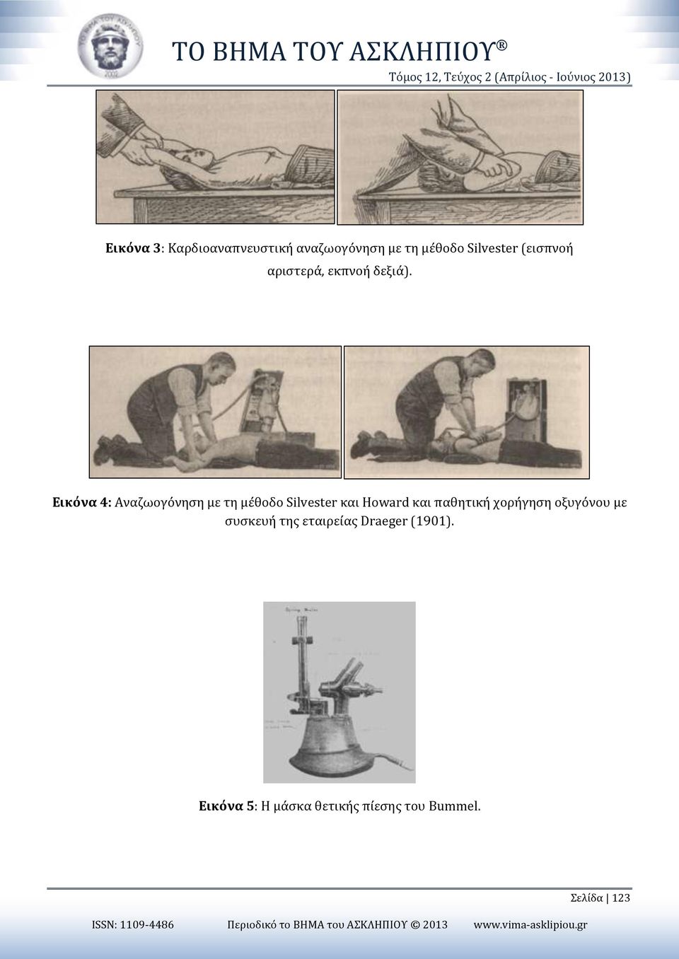 Εικόνα 4: Αναζωογόνηση με τη μέθοδο Silvester και Howard και παθητική χορήγηση οξυγόνου με συσκευή της