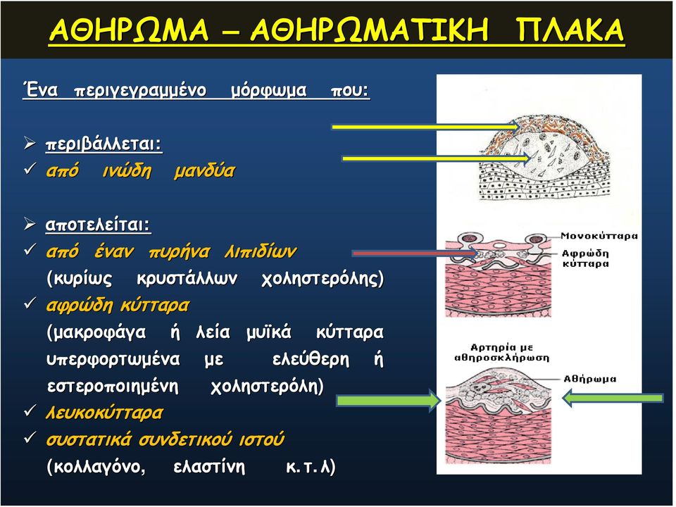 λεία υπερφορτωμένα εστεροποιημένη λευκοκύτταρα με λιπιδίων χοληστερόλης) μυϊκά