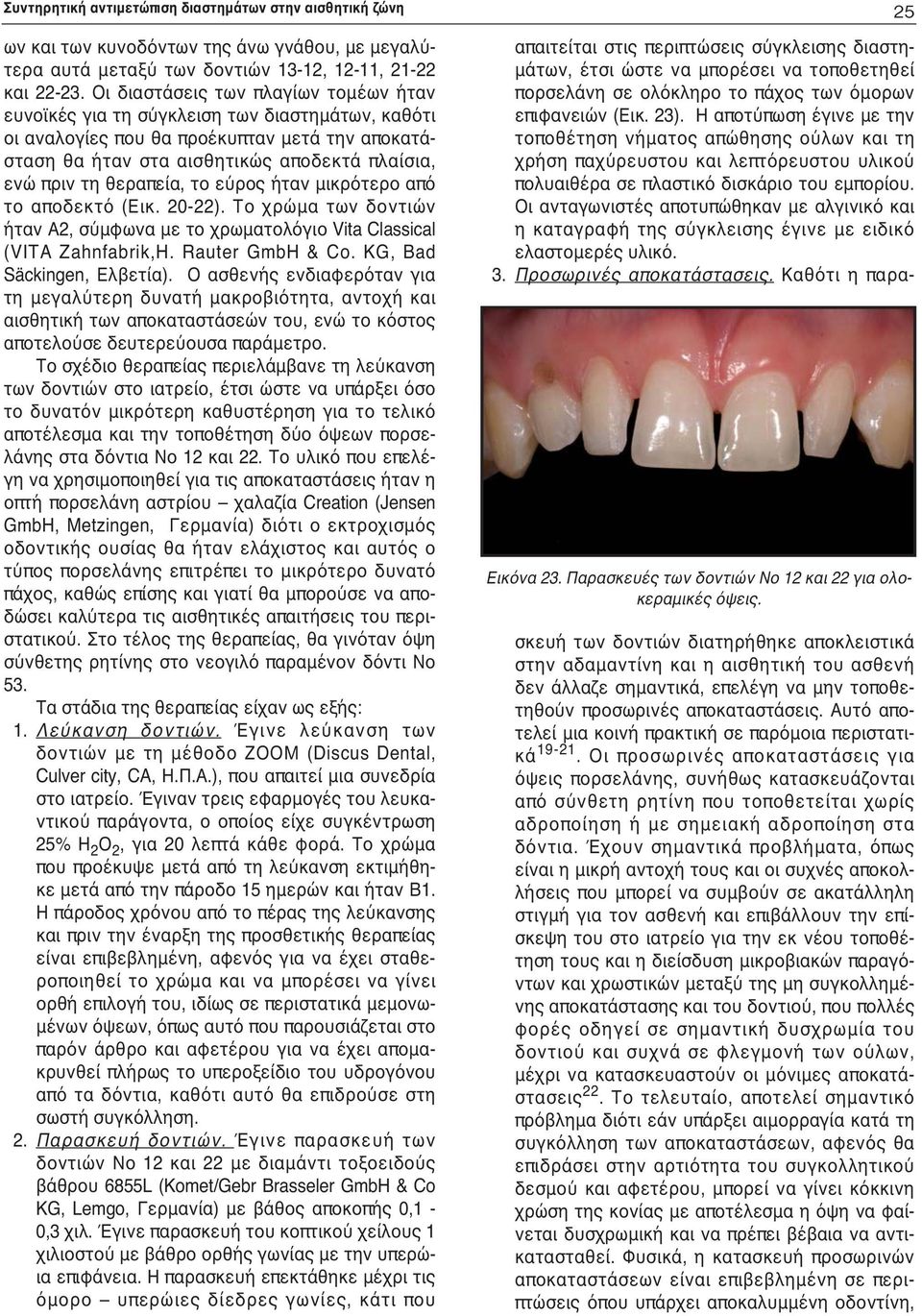 θεραπεία, το εύρος ήταν μικρότερο από το αποδεκτό (Εικ. 20-22). Το χρώμα των δοντιών ήταν Α2, σύμφωνα με το χρωματολόγιο Vita Classical (VITA Zahnfabrik,H. Rauter GmbH & Co.
