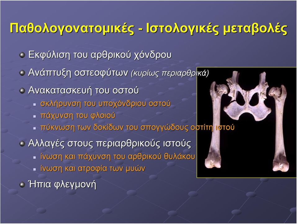 πάχυνση του φλοιού πύκνωση των δοκίδων του σπογγώδους οστίτη ιστού Αλλαγές στους