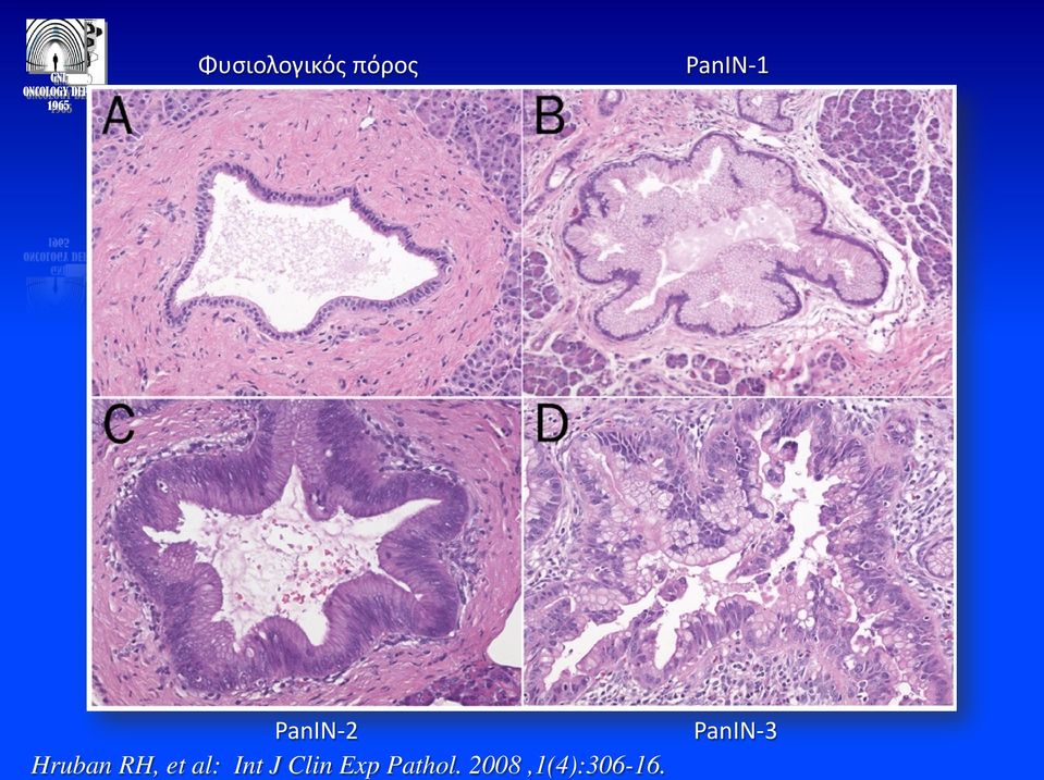 RH, et al: Int J Clin Exp