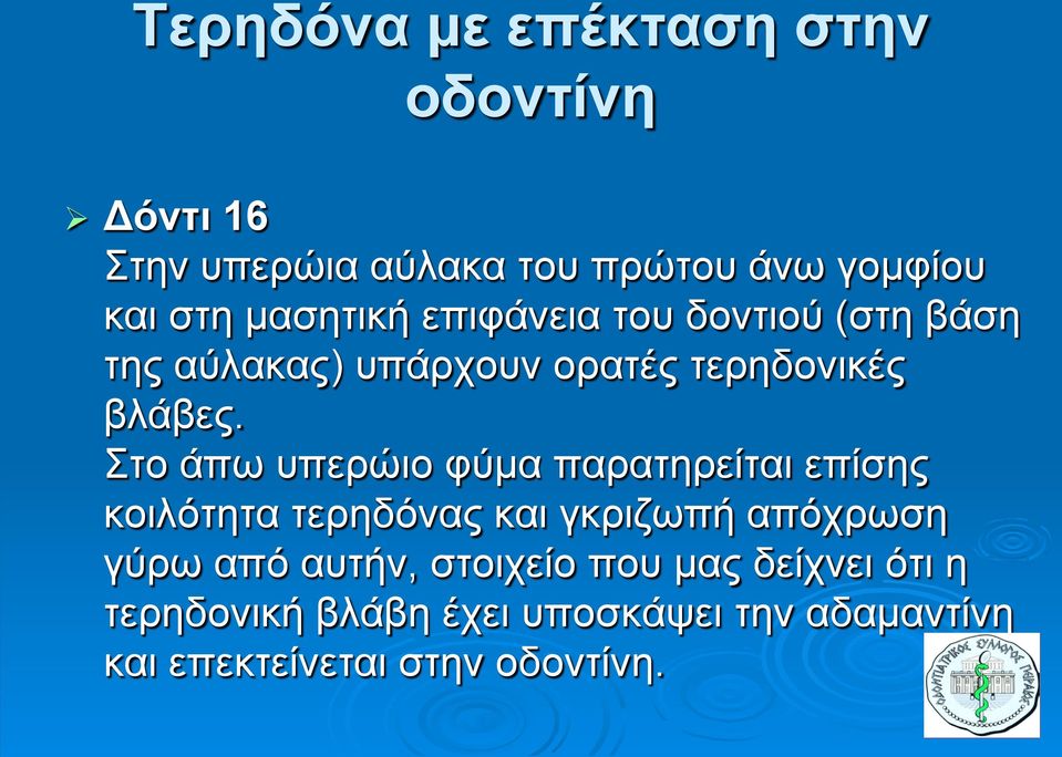 Στο άπω υπερώιο φύμα παρατηρείται επίσης κοιλότητα τερηδόνας και γκριζωπή απόχρωση γύρω από αυτήν,