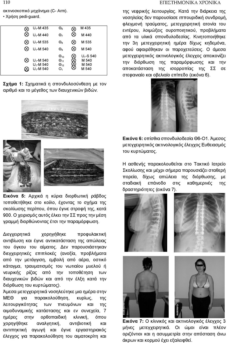 Κατά την διάρκεια της νοσηλείας δεν παρουσίασε ιππουριδική συνδρομή, φλεγμονή τραύματος, μετεγχειρητική ατονία του εντέρου, λοιμώξεις ουροποιητικού, προβλήματα από τα υλικά σπονδυλοδεσίας.