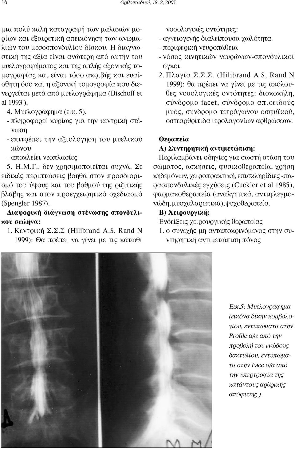 µυελογράφηµα (Bischoff et al 1993 ). 4. Μυελογράφηµα (εικ. 5). - πληροφορεί κυρίως για την κεντρική στένωση - επιτρέπει την αξιολόγηση του µυελικού κώνου - αποκλείει νεοπλασίες 5. Η.Μ.Γ.