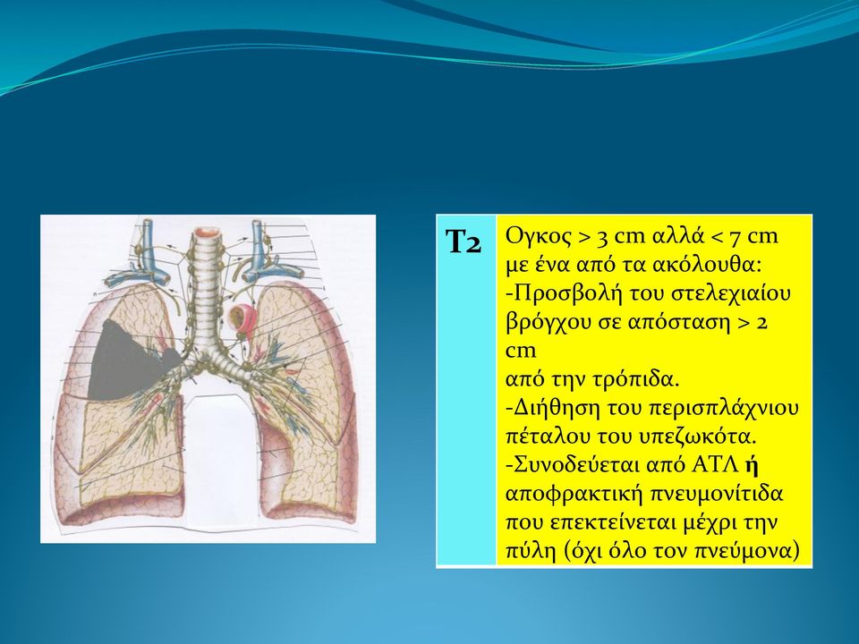 του!περισπλάχνιου! πέταλου!του!υπεζωκότα.! w Συνοδεύεται!από!ΑΤΛ!