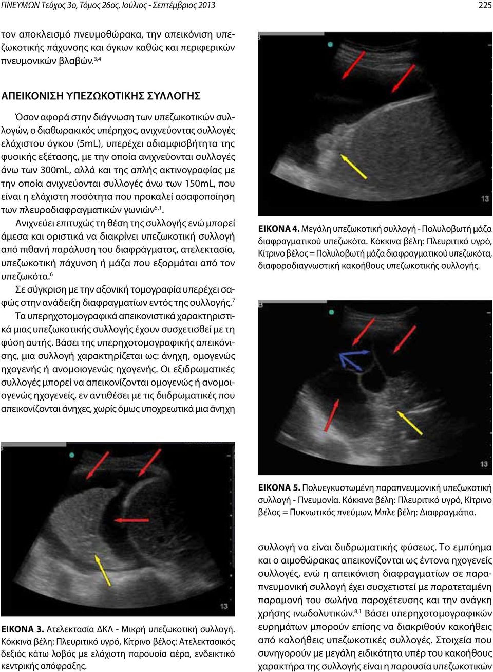 εξέτασης, με την οποία ανιχνεύονται συλλογές άνω των 300mL, αλλά και της απλής ακτινογραφίας με την οποία ανιχνεύονται συλλογές άνω των 150mL, που είναι η ελάχιστη ποσότητα που προκαλεί ασαφοποίηση