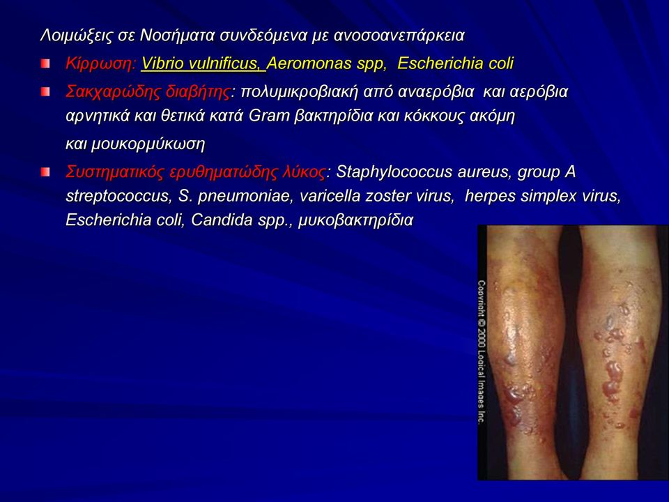 και κόκκους ακόμη και μουκορμύκωση Συστηματικός ερυθηματώδης λύκος: Staphylococcus aureus, group A