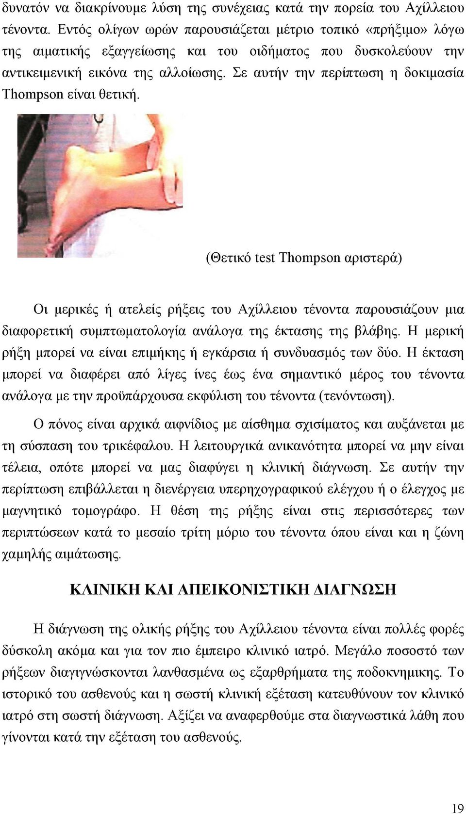 Σε αυτήν την περίπτωση η δοκιµασία Thompson είναι θετική.