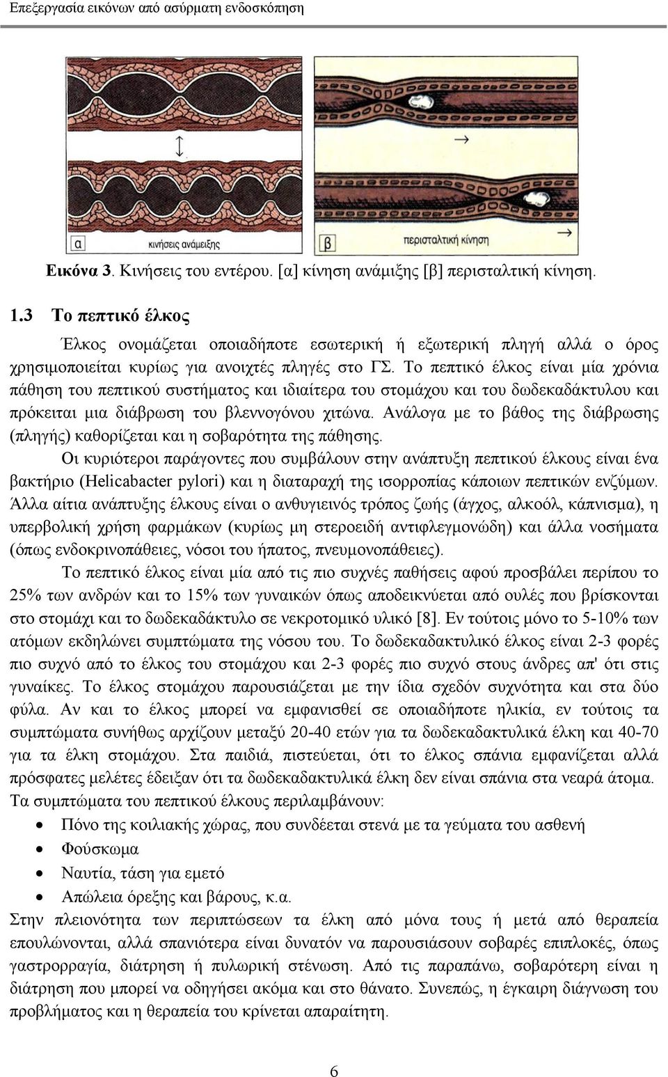 Το πεπτικό έλκος είναι μία χρόνια πάθηση του πεπτικού συστήματος και ιδιαίτερα του στομάχου και του δωδεκαδάκτυλου και πρόκειται μια διάβρωση του βλεννογόνου χιτώνα.