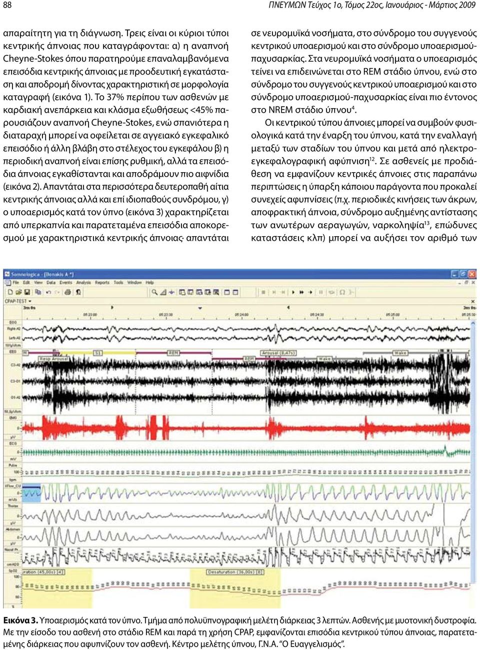 δίνοντας χαρακτηριστική σε μορφολογία καταγραφή (εικόνα 1).