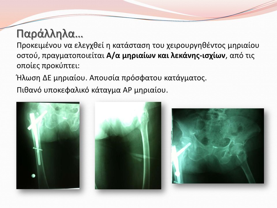 και λεκάνης-ισχίων, από τις οποίες προκύπτει: Ήλωση ΔΕ