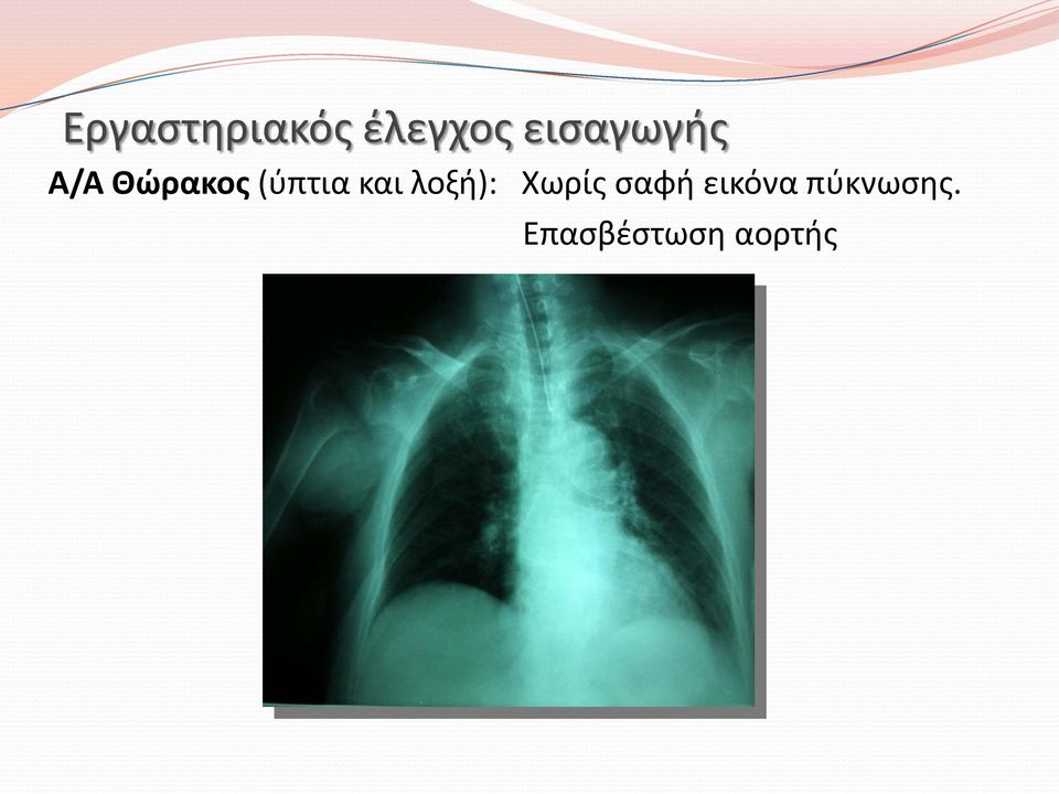 (ύπτια και λοξή): Χωρίς