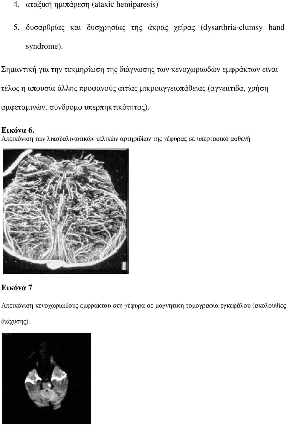 µικροαγγειοπάθειας (αγγειίτιδα, χρήση αµφεταµινών, σύνδροµο υπερπηκτικότητας). Εικόνα 6.