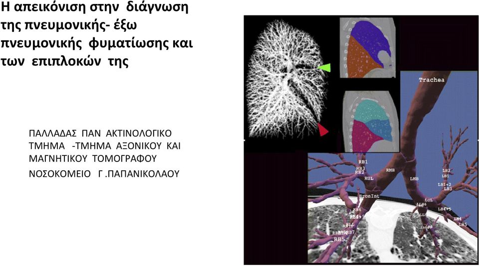 ΠΑΛΛΑΔΑΣ ΠΑΝ ΑΚΤΙΝΟΛΟΓΙΚΟ ΤΜΗΜΑ ΤΜΗΜΑ ΑΞΟΝΙΚΟΥ