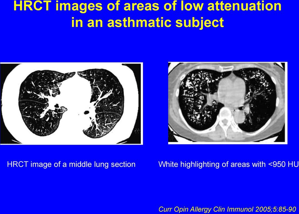 section White highlighting of areas with <950