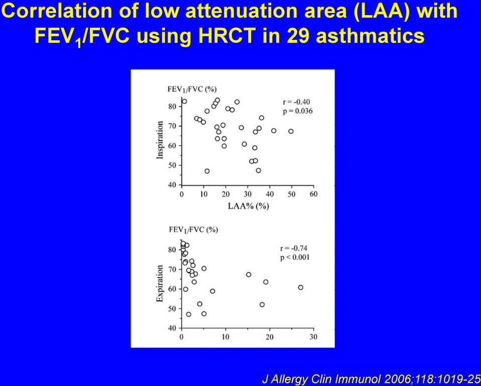 using HRCT in 29 asthmatics J