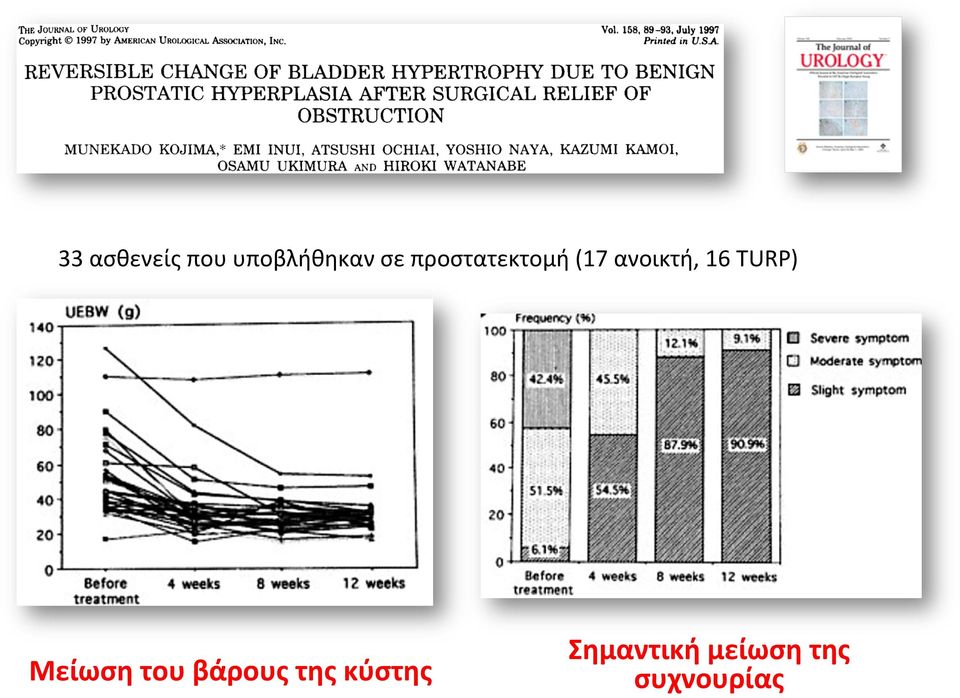 TURP) Μείωση του βάρους της