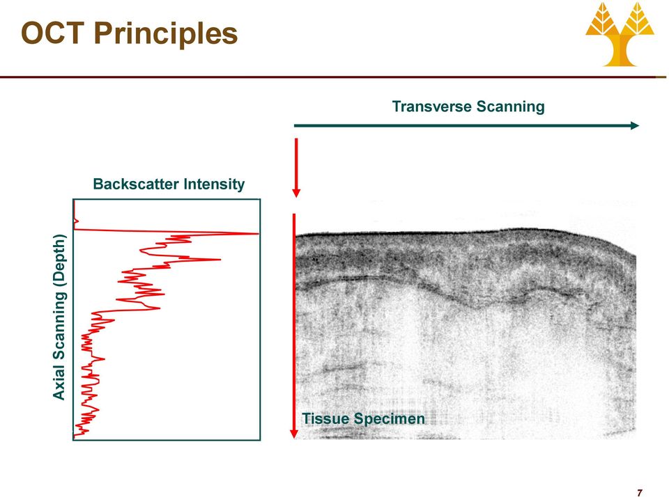 Transverse Scanning