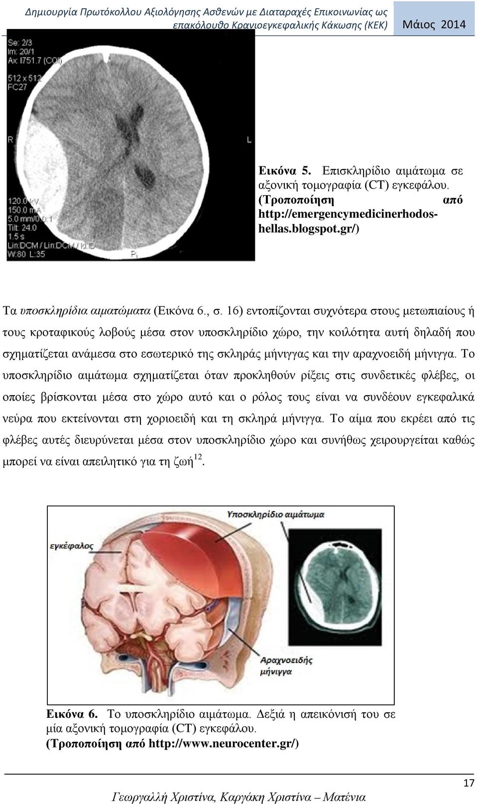 αραχνοειδή μήνιγγα.